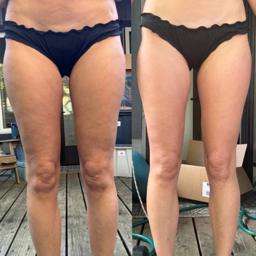 GlowSculpt™ Rejuvenating Face Lifter