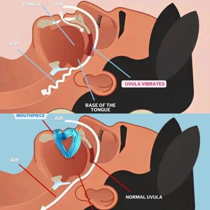 Wellorea™ - Mouth Guard